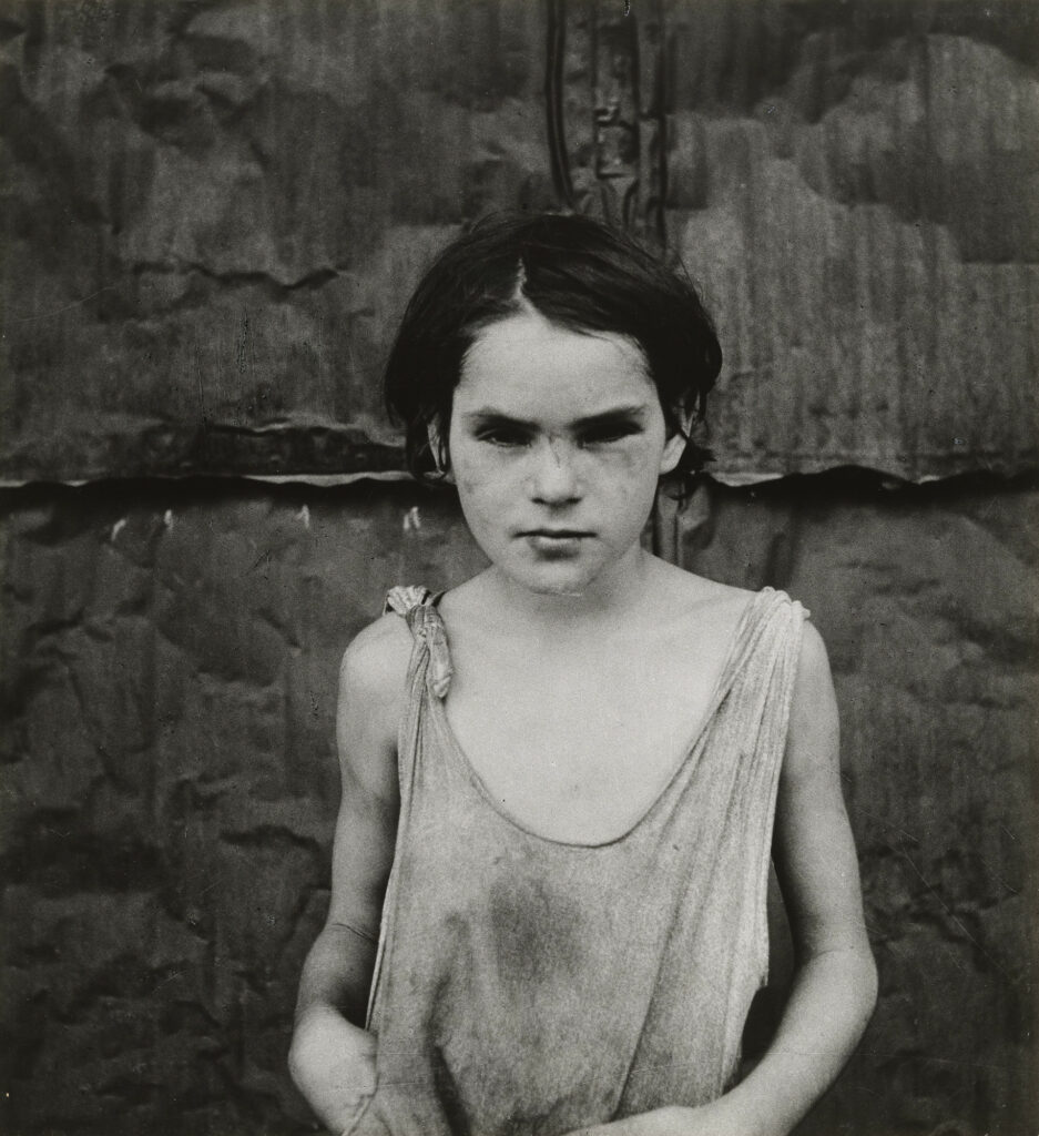 vacances scolaires. Dorothea Lange, Damaged Child, Shacktown Elm Grove, Oklahoma, August 1936